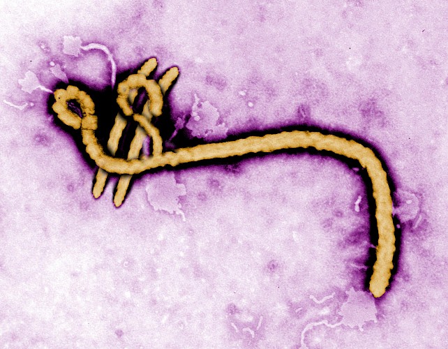 Original: Ebola virus by Frederick A. Murphy/CDC https://www.osha.gov/SLTC/ebola/. Modification by Lukas Henne, 3 November 2015
