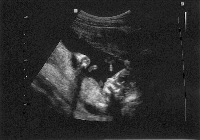 'Third Sonogram'. Photo by Ulises Jorge, date unknown (Licensed under CC BY-NC-SA 2.0)